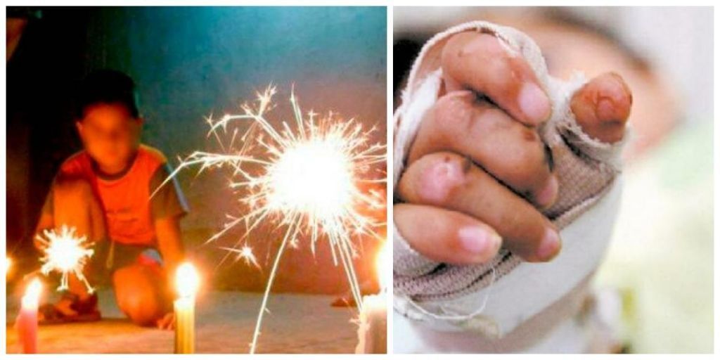 Reportan primeros quemados por pólvora en Ibagué, en la noche de las velitas