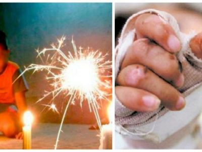 Reportan primeros quemados por pólvora en Ibagué, en la noche de las velitas